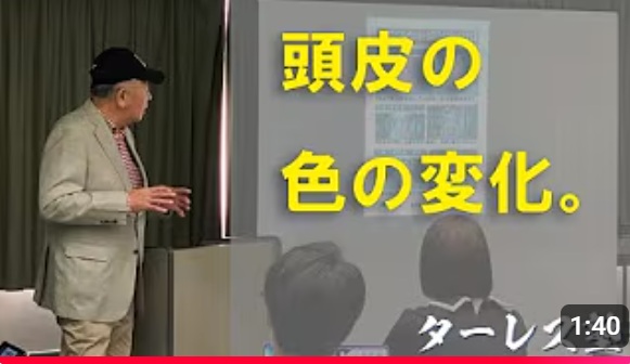 第9回 頭皮の色の変化。